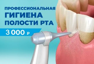 Профессиональная чистка зубов