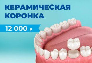 Коронка керамическая на каркасе из диоксида циркония