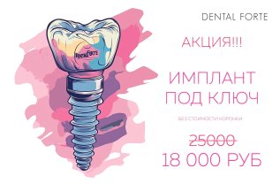 Имплантация со скидкой