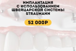 Имплантация с использованием швейцарской системы