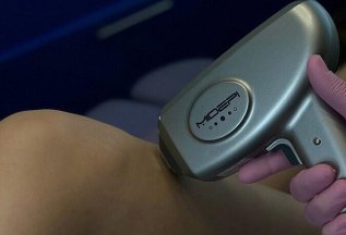 Лазерная эпиляция руки на аппарате MIDEPI со скидкой 20%