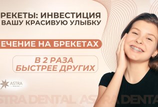 Брекеты: Инвестиция в красивую улыбку