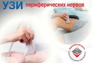 УЗИ периферических нервов