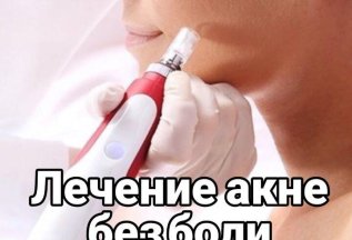 Лечение акне без боли