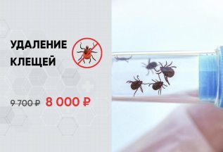Удаление клещей 8000₽