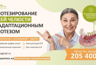 Протезирование всей челюсти на 6 имплантах