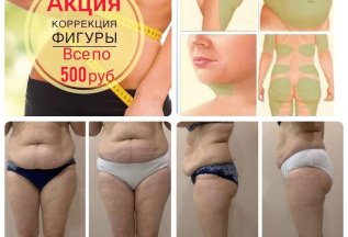 Коррекция фигуры – ВСЕГО по 500 рублей!