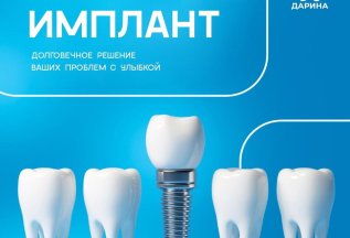 Имплантация в стоматологии 
