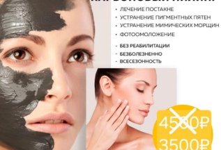 Карбоновый пилинг - 3500р