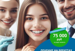 Лечение на брекетах DAMON Q 75000 рублей