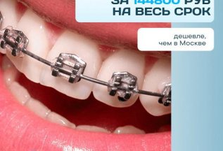 Брекеты 144800 ₽ на весь срок лечения