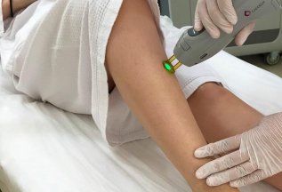 АКЦИЯ Лазерная эпиляция БИКИНИ ГОЛЕНИ БЕДРА -15%