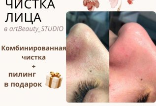 Пилинг в подарок