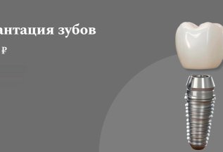 Имплантация зубов от 22000 руб