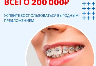 Брекеты DAMON Q в рассрочку