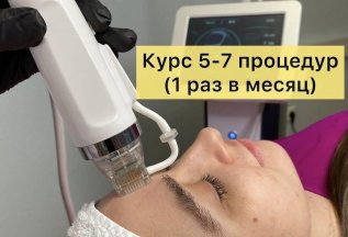 Микроигольчатый RF-лифтинг