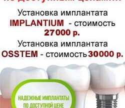 Имплантация зубов по доступным ценам!