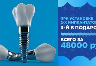 2+1 имплантация зубов