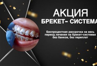 Брекет-система в рассрочку