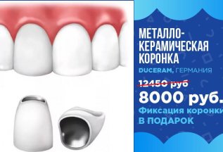 Металлокерамическая коронка