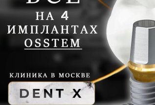 Всё на 4 - х имплантах Osstem