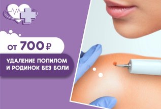 УДАЛЕНИЕ РОДИНОК ОТ 700 РУБ.