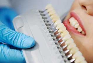 Отбеливание зубов в стоматологической клинике GIONIX