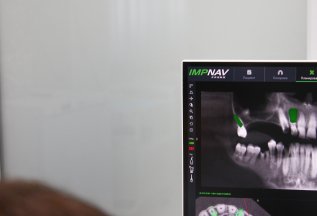 ВПЕРВЫЕ В Воронеже! Навигационная хирургия IMPNAV