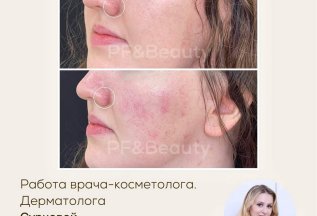 Lumecca -10%