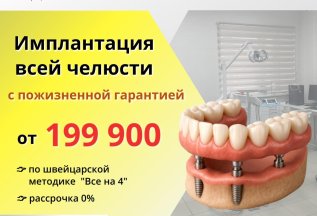Имплантация всей челюсти