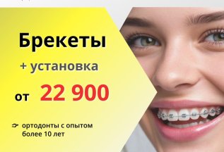 Брекеты с установкой 22900₽