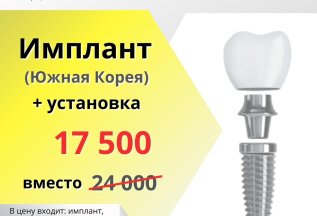 Имплант + установка =17 500 р