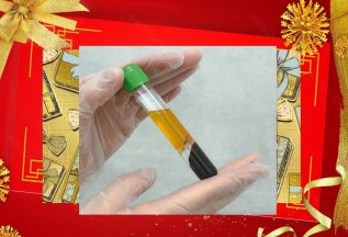 Плазмолифтинг
