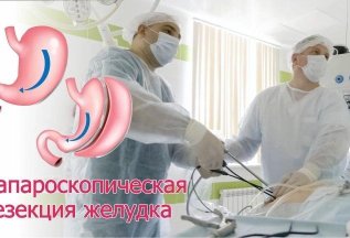 Прием бариатрического хирурга
