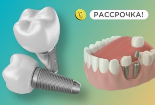 Имплант с циркониевой корнкой всего за 15ю000 рублей в месяц