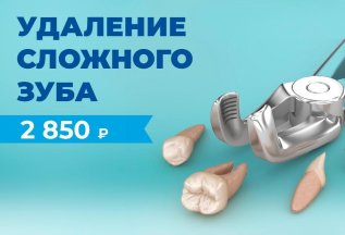 Удаление зуба