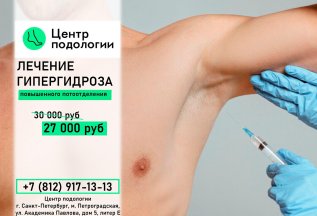 Лечение гипергидроза (повышенного потоотделения)