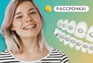 Брекеты всего за 20.000 рублей в месяц!