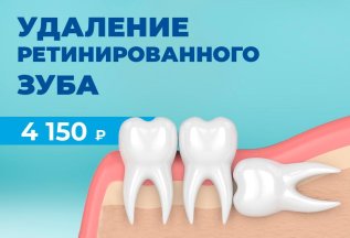 Удаление ретированного зуба
