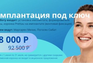 Акция на имплантацию!