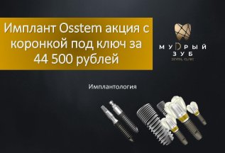 Имплант Osstem АКЦИЯ с коронкой под ключ за 44 500 рублей!