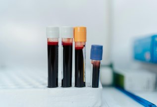 Скидка 10% на все лабораторные услуги