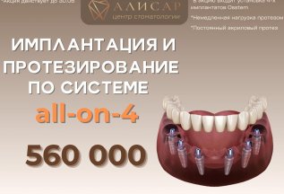 Имплантация и протезирование 