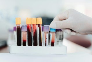 Скидка 15% на все виды анализов каждый вторник и пятницу
