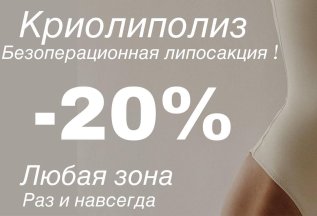 Криолиполиз скидка 20%