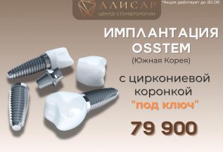 Имплантация Osstem (Южная Корея) 