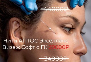 2️⃣ Нитевая подтяжка лица
