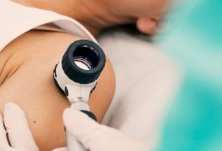 Лазерное и фотодинамическое удаление новообразований