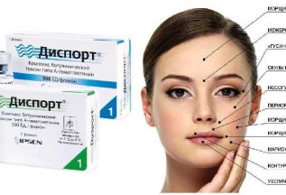 Избавление от морщин препаратом Диспорт