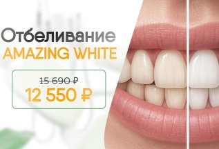 Отбеливание зубов Amazing White